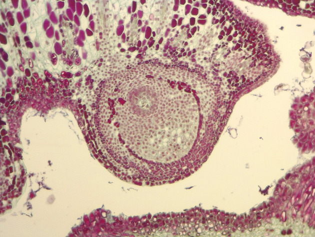 Female Pine Ovule Slides - Female Pine Ovule 03 100X